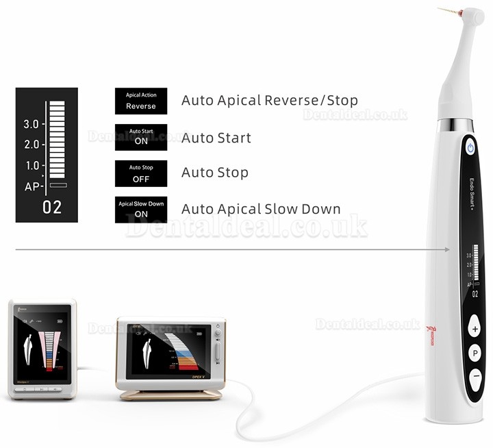 Woodpecker Endo Smart+ Dental Wireless Endodontic Motor with Reciprocating